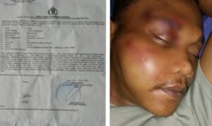 Pemuda di Lutra Sulsel Diduga Dianiaya Brimob, Keluarga Tempuh Jalur Hukum